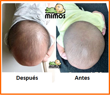 Cojin Mimos Mexico - La plagiocefalia o cabeza plana por posición